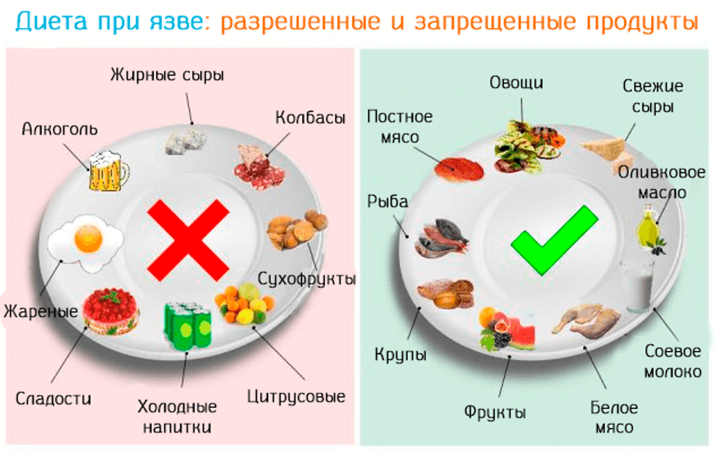Список запрещенных продуктов